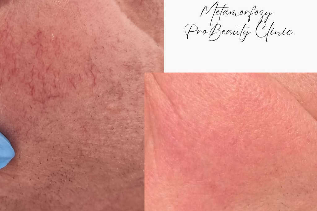 Metamorfozy Pro Beauty Clinic