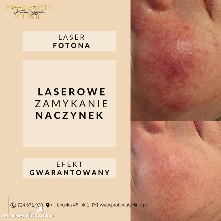 Metamorfozy Pro Beauty Clinic