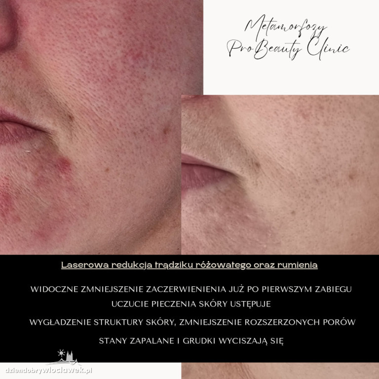 Metamorfozy Pro Beauty Clinic