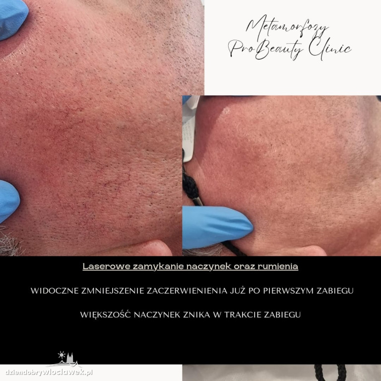 Metamorfozy Pro Beauty Clinic