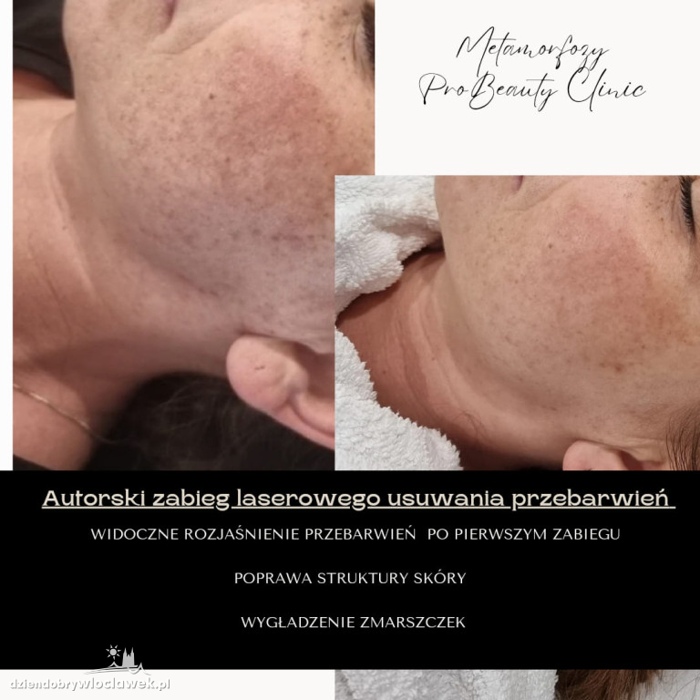 Metamorfozy Pro Beauty Clinic