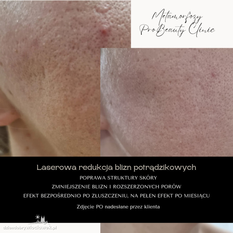 Metamorfozy Pro Beauty Clinic