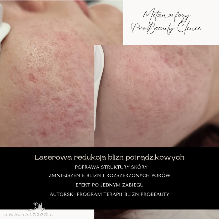 Metamorfozy Pro Beauty Clinic