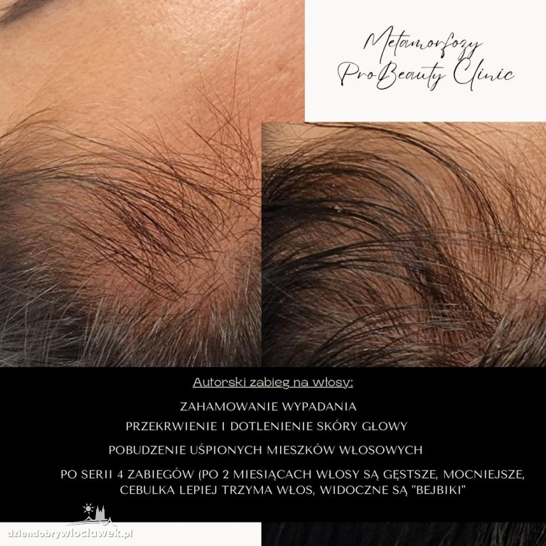 Metamorfozy Pro Beauty Clinic