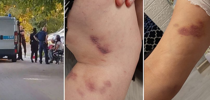 "Otworzyła piwo w parku" i TAK SKOŃCZYŁA. Policjanci byli zbyt brutalni?