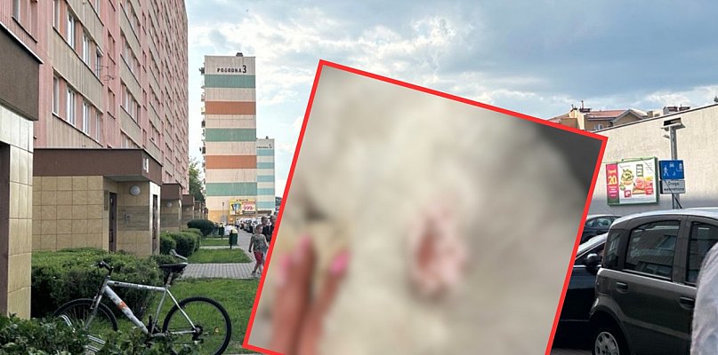 Pies został trafiony w trakcie spaceru. Właścicielka nie kryje emocji - 80782
