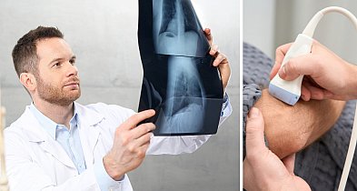 Czekasz na wizytę w ramach NFZ? Tak wyglądają terminy u ortopedy-81378